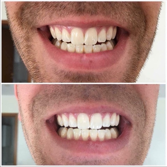 (1) AP24 Whitening toothpaste - Picture 2 of 3